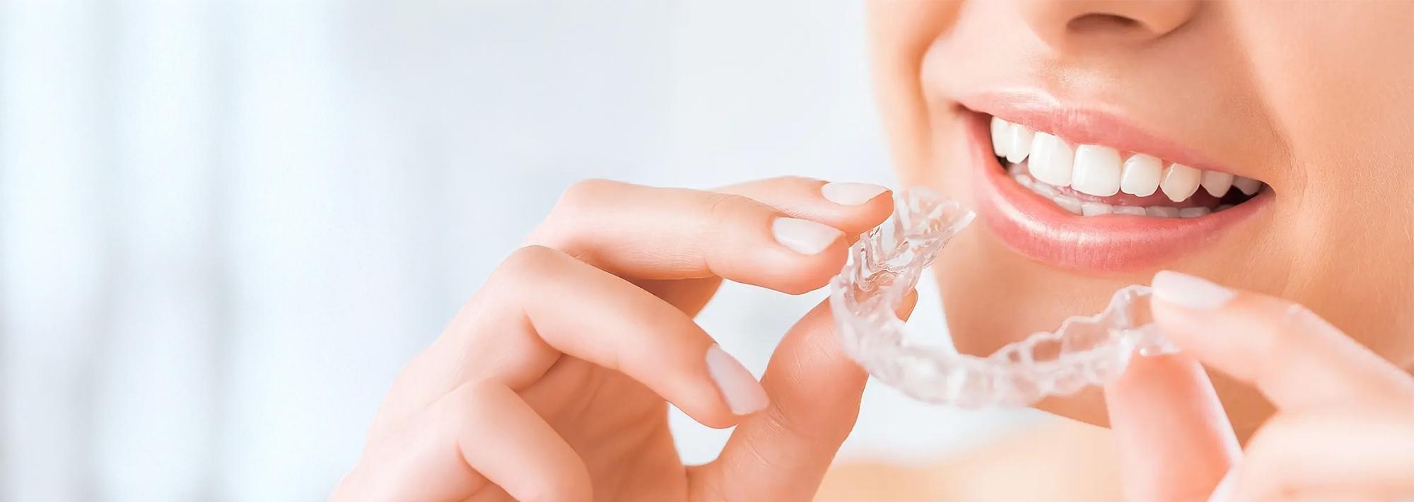 アライナー矯正