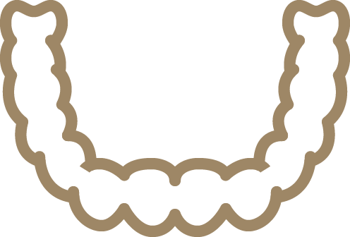 アライナー矯正