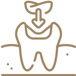 詰め物・かぶせ物<br />
が取れた